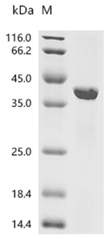 PPP2CA Protein, Human, Recombinant (His & Myc)