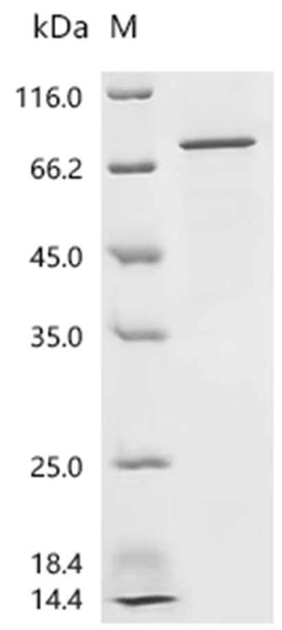 IRF1 Protein, Human, Recombinant (GST & His)