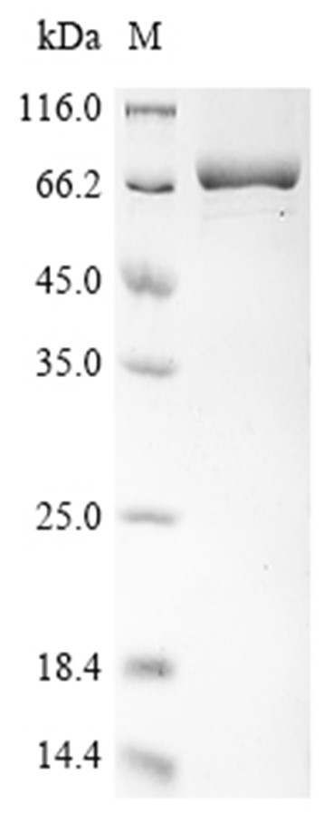 TXNRD2 Protein, Human, Recombinant (U523S, His & SUMO)