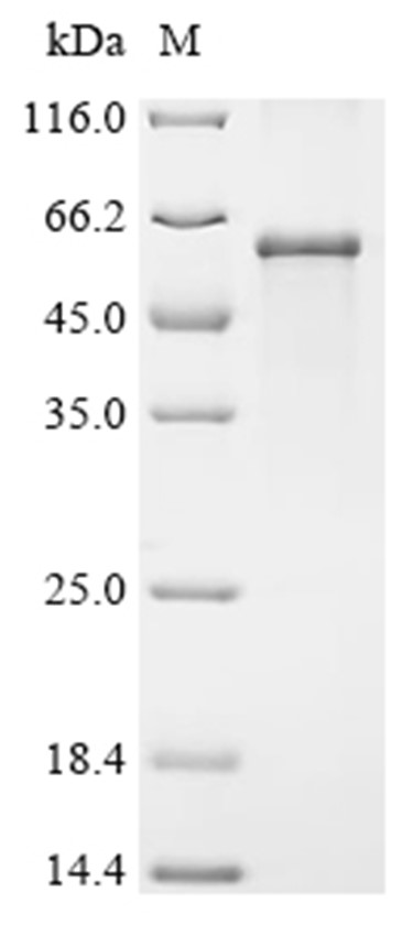 Isthmin-1/ISM1 Protein, Human, Recombinant (His)