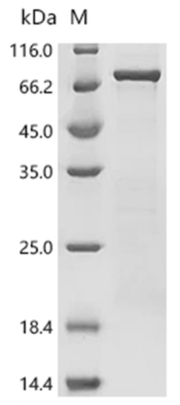 Merlin Protein, Human, Recombinant (His)