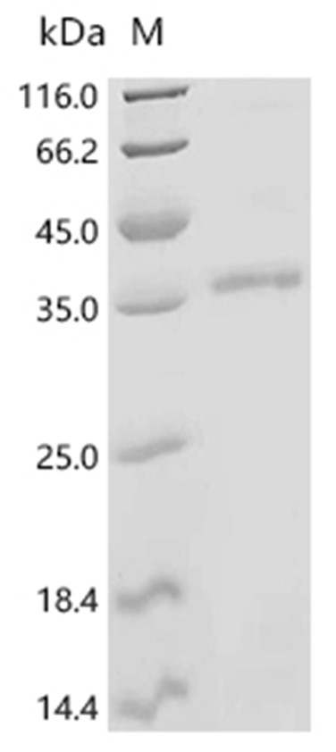 DCAF16 Protein, Human, Recombinant (His & Myc)