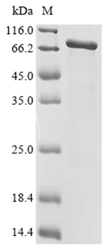YAP1 Protein, Human, Recombinant (E. coli, His)