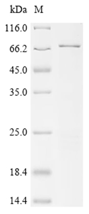 p53 Protein, Human, Recombinant (His & SUMO)