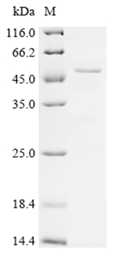 ELANE Protein, Human, Recombinant (GST)