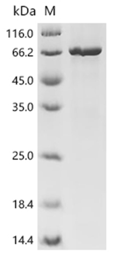 GRM5 Protein, Human, Recombinant (His & Myc)