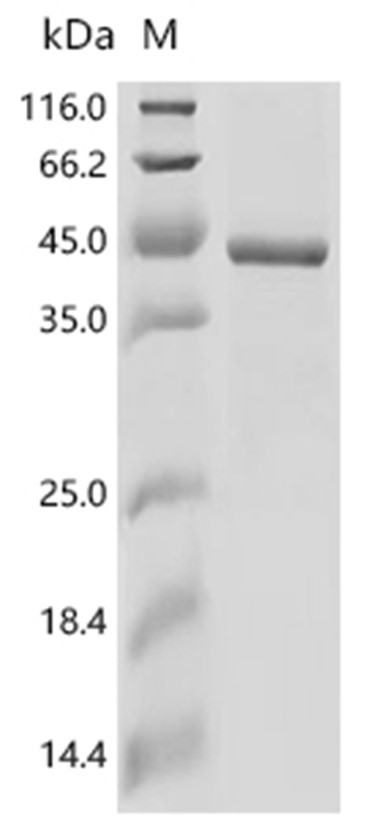 CLN5 Protein, Human, Recombinant (His)