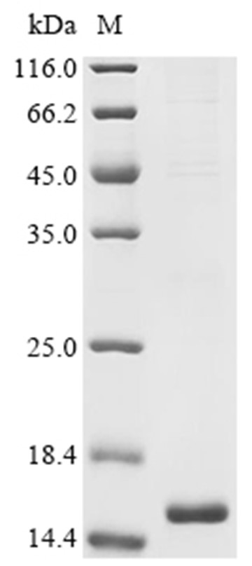 PFS230 Protein, Plasmodium falciparum, Recombinant