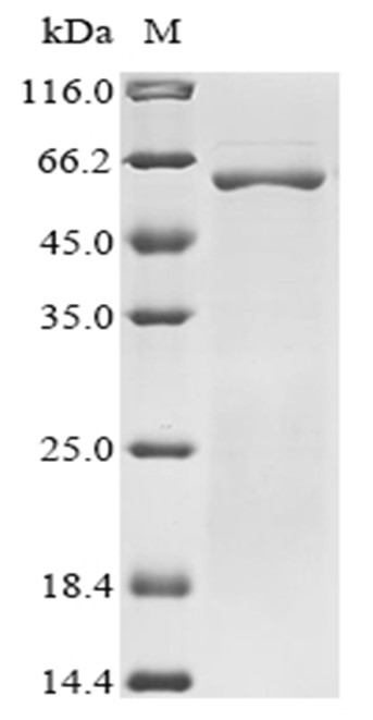 PDHX Protein, Human, Recombinant (His & Myc)