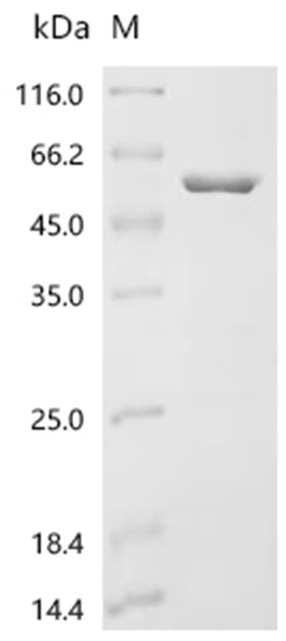 NEFL Protein, Human, Recombinant (His & SUMO)