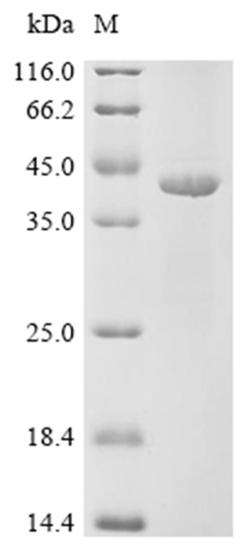 PZP Protein, Human, Recombinant (His)