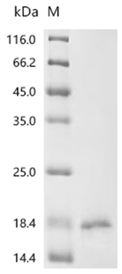 MAST4 Protein, Human, Recombinant (His & Myc)