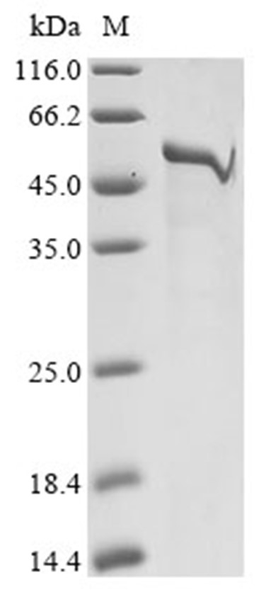 OmpD Protein, Salmonella typhimurium, Recombinant (His & SUMO)