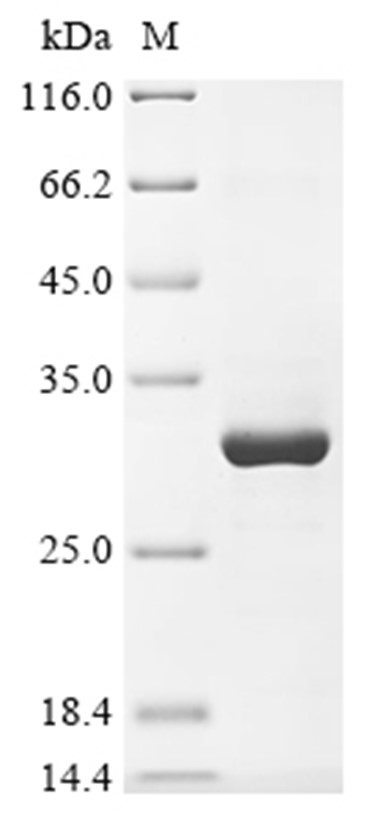 TRPA1 Protein, Rat, Recombinant (His & Myc)
