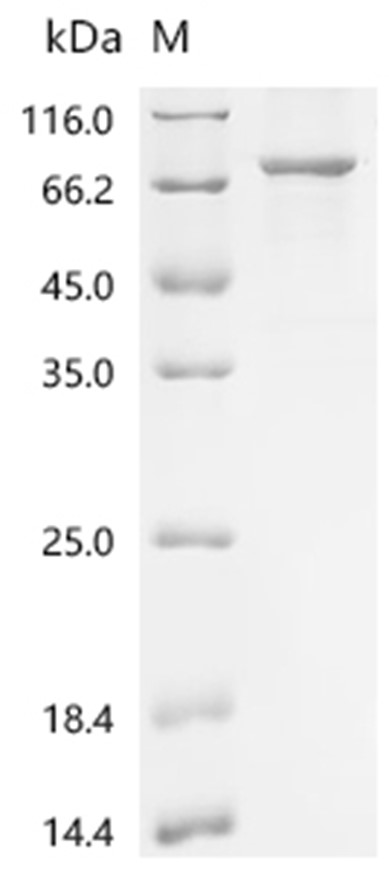 IRAK3 Protein, Mouse, Recombinant (E. coli, His & Myc)