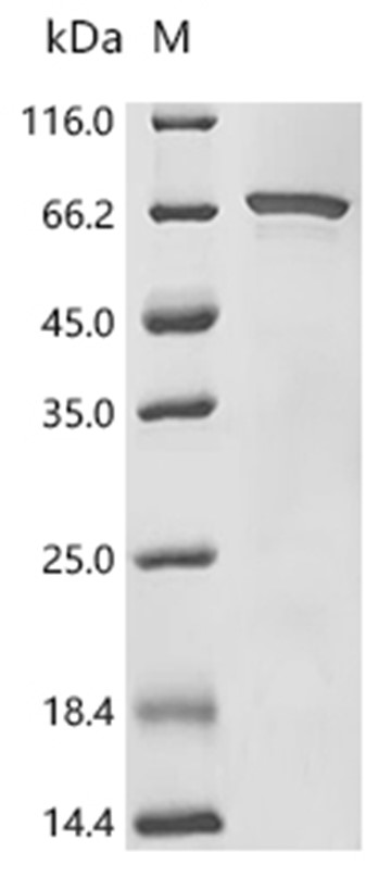 UGDH Protein, Human, Recombinant (His & SUMO)