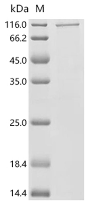 Perforin-1/PRF1 Protein, Human, Recombinant (His & MBP)