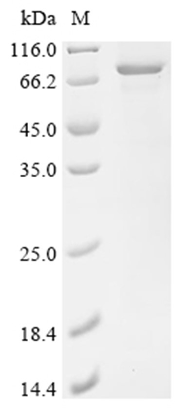 Perforin-1/PRF1 Protein, Human, Recombinant (His & SUMO)