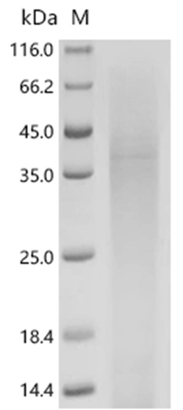 YBX1 Protein, Mouse, Recombinant (His)
