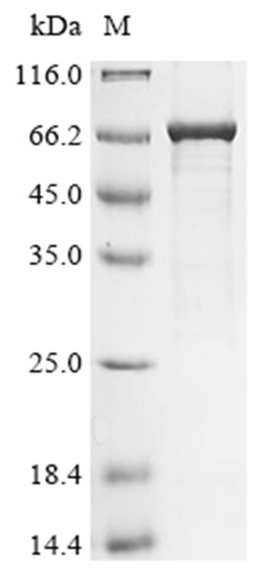 Rabies virus (RABV) (strain CVS-11) Glycoprotein (His & Myc & SUMO)