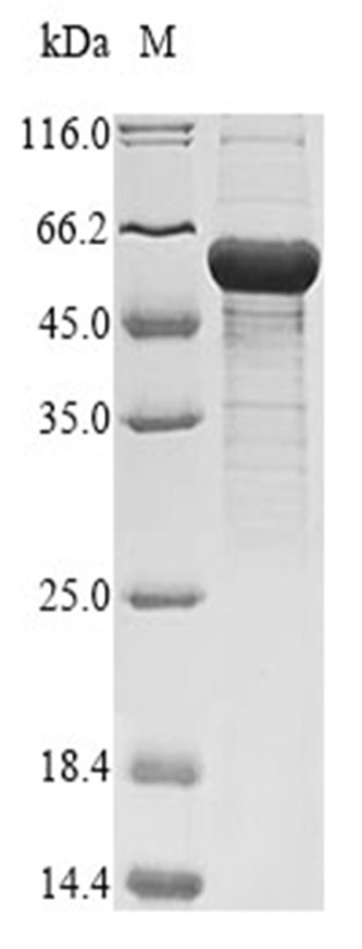 OXCT1 Protein, Human, Recombinant (His)