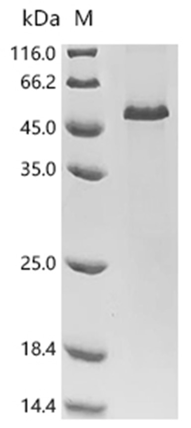 SLIT2 Protein, Mouse, Recombinant (His & Myc)