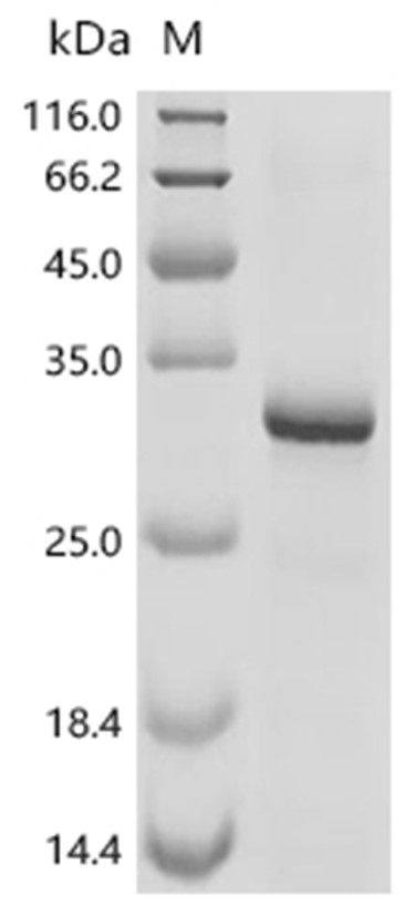 ADAMTS13 Protein, Mouse, Recombinant (His & Myc)