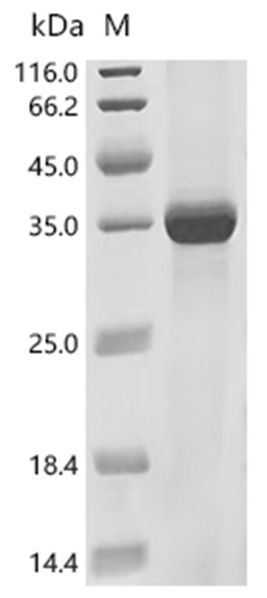 ABCC1 Protein, Human, Recombinant (His)
