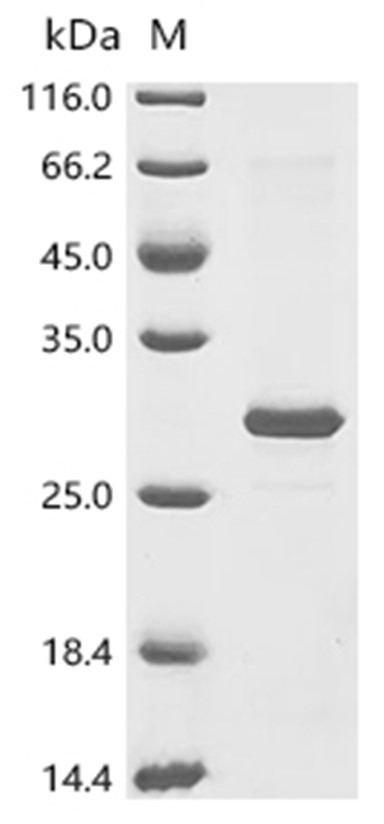NOX4 Protein, Human, Recombinant (E. coli, His)