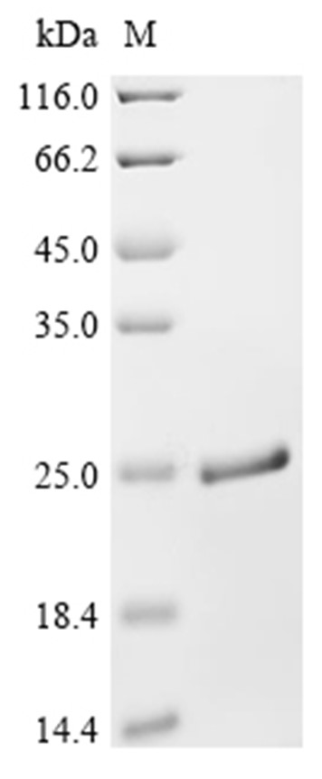Pal Protein, Legionella pneumophila, Recombinant (E. coli, His)