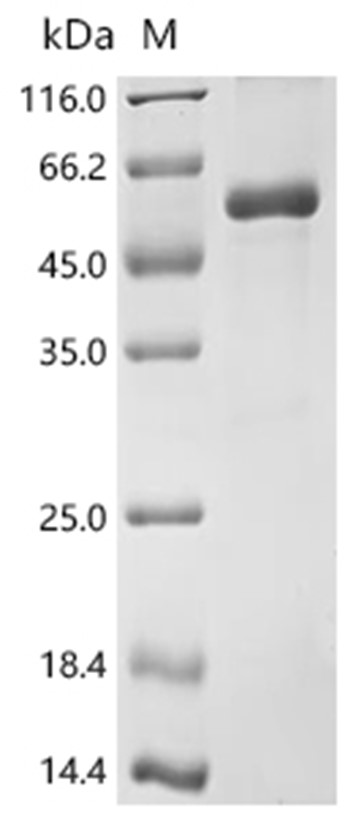 NR2F1 Protein, Human, Recombinant (His)