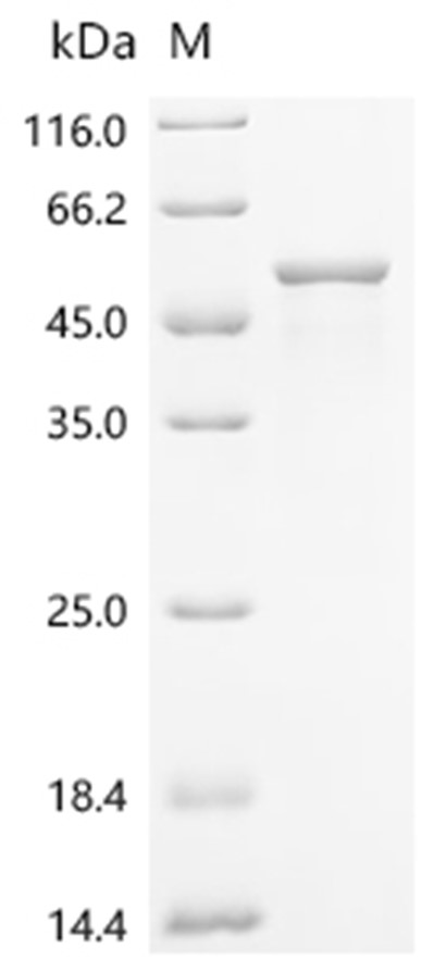 RIPK1 Protein, Human, Recombinant (His & Myc)
