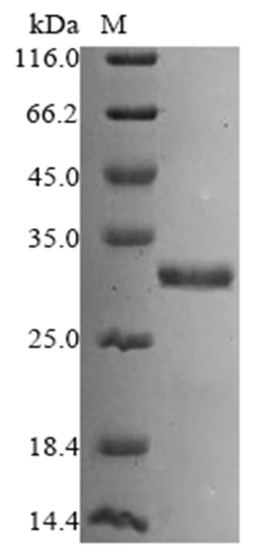 YPEL3 Protein, Human, Recombinant (His & SUMO)