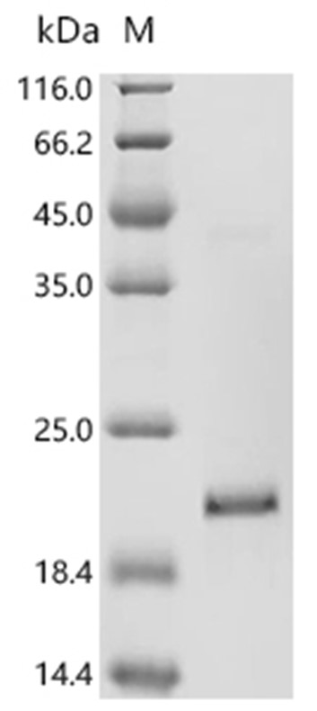 PLA2G10 Protein, Mouse, Recombinant (His & Myc)