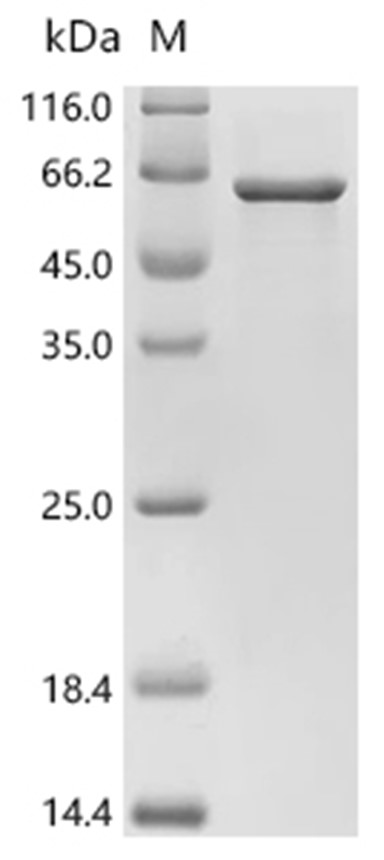 AADAC Protein, Human, Recombinant (His & Myc & SUMO)