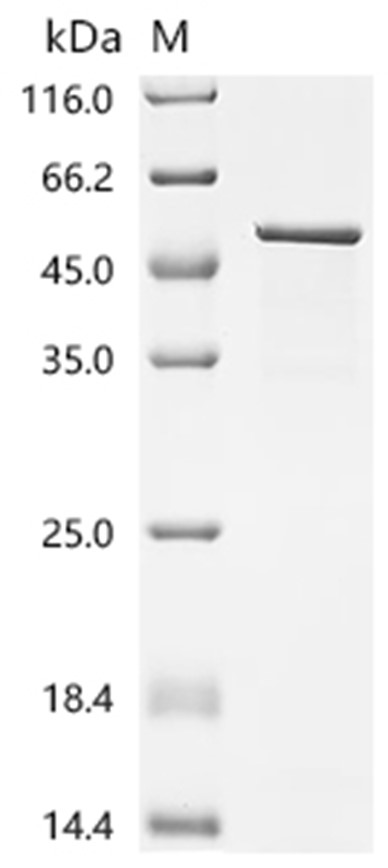 TEAD3 Protein, Human, Recombinant (His & SUMO)