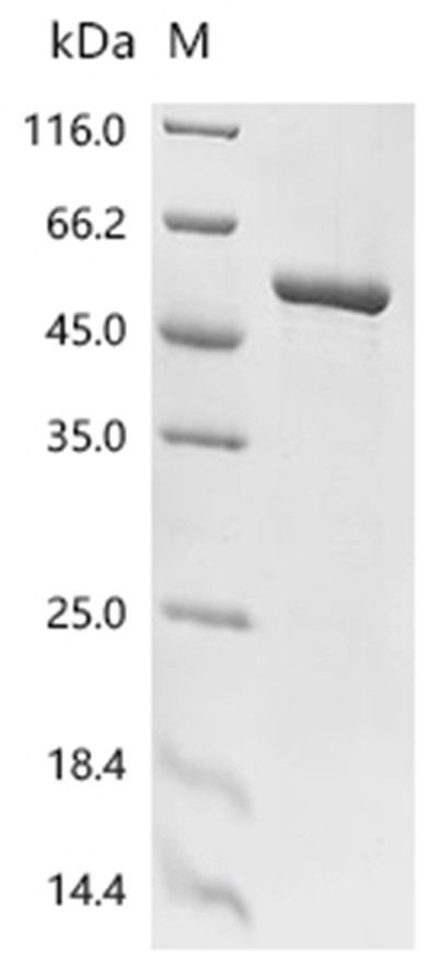 Aromatase/CYP19A1 Protein, Human, Recombinant (His)