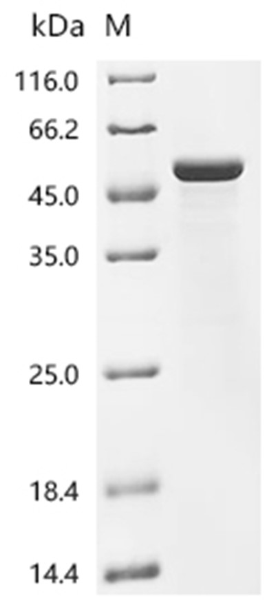 KRT18 Protein, Human, Recombinant (E. coli, His)
