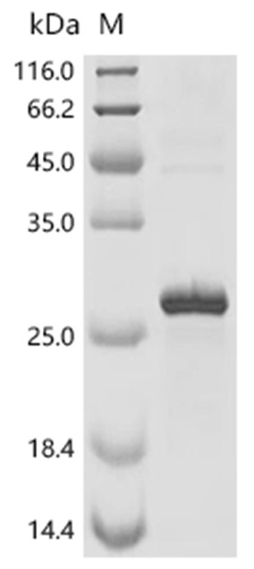 PRNP Protein, Rat, Recombinant (His)