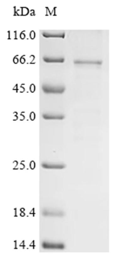 TXNIP Protein, Human, Recombinant (B2M & His)