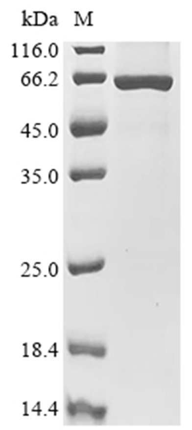 KAT5 Protein, Human, Recombinant (His)
