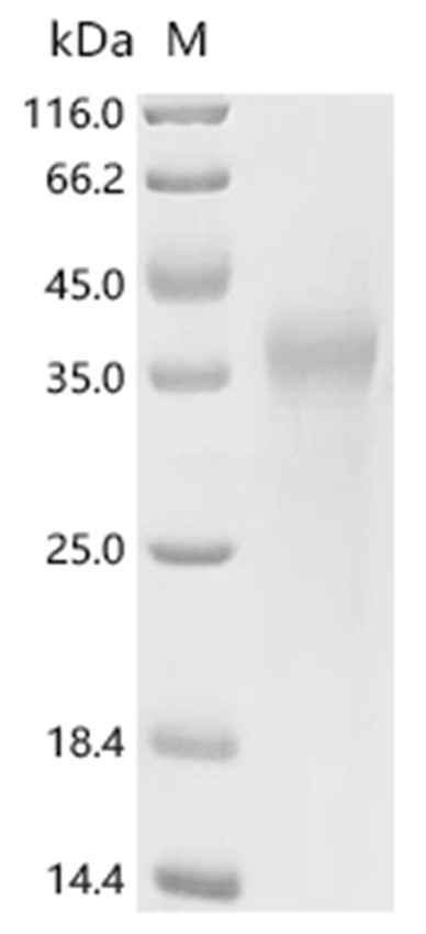 Dystonin Protein, Human, Recombinant (His)