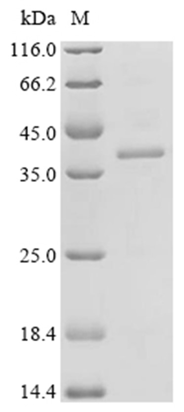 THBS1 Protein, Mouse, Recombinant (His)