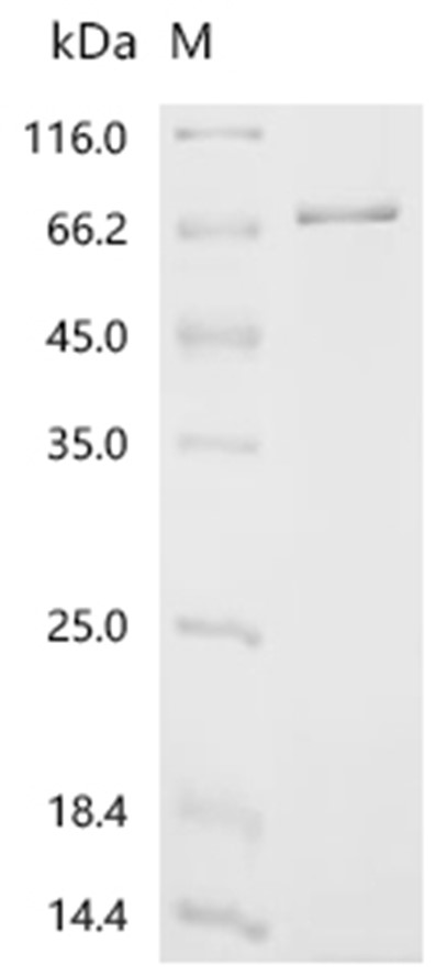FCRL3 Protein, Human, Recombinant (His)