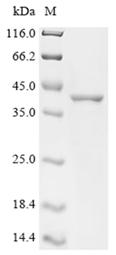 Ataxin-8 Protein, Human, Recombinant (GST)
