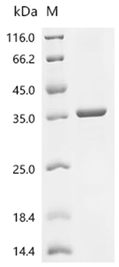 CYBB Protein, Human, Recombinant (His)