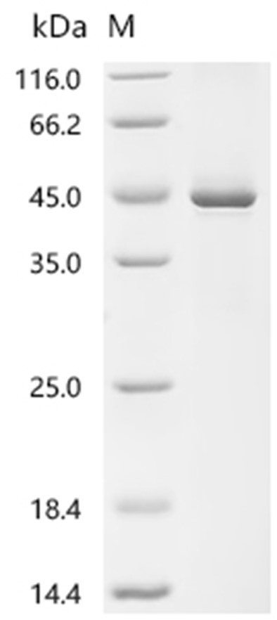 HSD11B1 Protein, Human, Recombinant (His & SUMO)