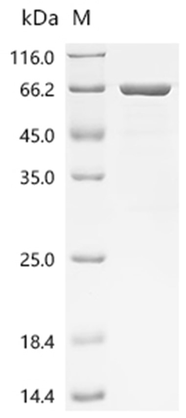 KRT8 Protein, Human, Recombinant (His & SUMO)