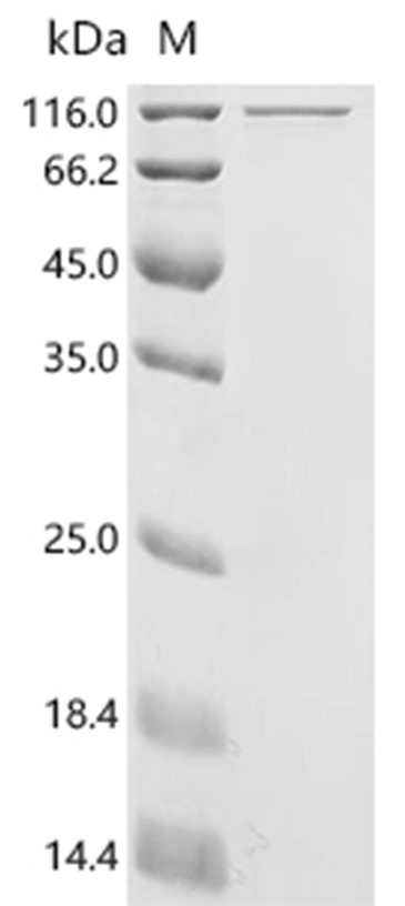 Adeno-associated virus 2 (isolate Srivastava/1982) Rep78 Protein (His & MBP)