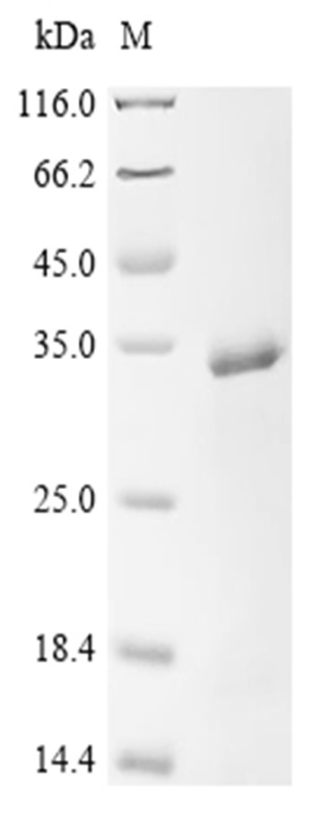 Thrombin-like enzyme contortrixobin Protein, Agkistrodon contortrix, Recombinant (His & Myc)